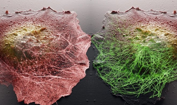 Новая технология дает невероятные возможности наблюдения за внутренней жизнью клеток