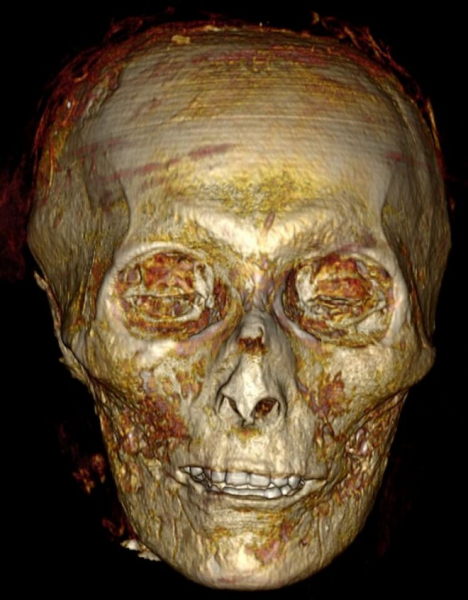 Компьютерная томография помогла «снять бинты» с мумии фараона Аменхотепа I
