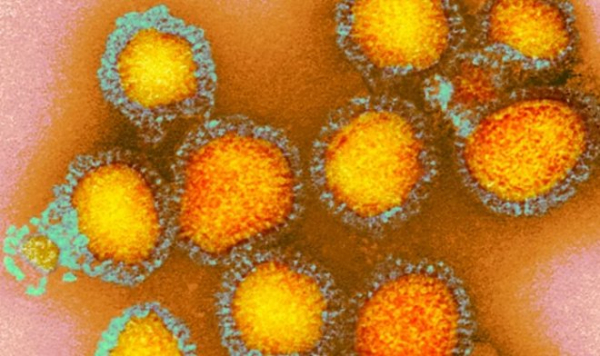 Загадочный «Русский грипп» XIX века, вероятно, был первой эпидемией коронавируса в мире