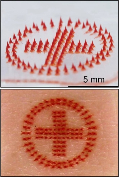 Пластыри с микроиглами сделают татуировки дешевыми и безболезненными