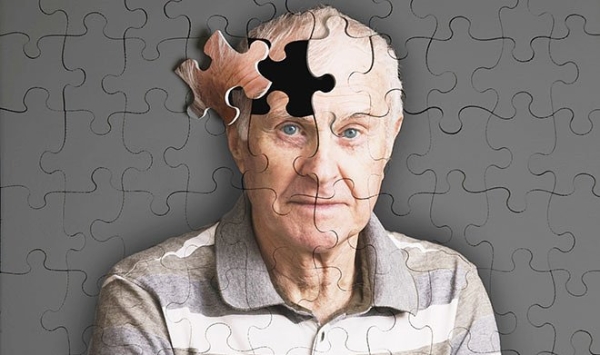 Российские ученые открыли перспективный метод лечения людей с болезнью Альцгеймера