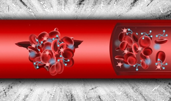 Инъекции синтетических тромбов помогут безопасно остановить кровотечение