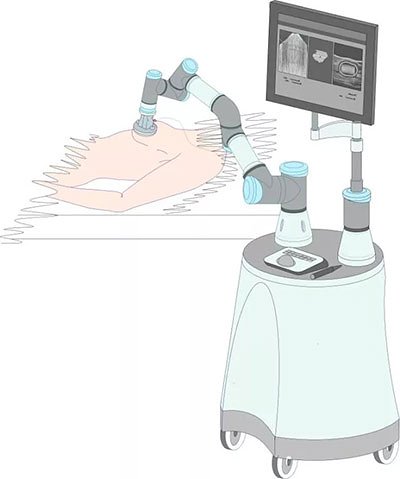 В СПбПУ разработали аппарат для лечения опухолей ультразвуком