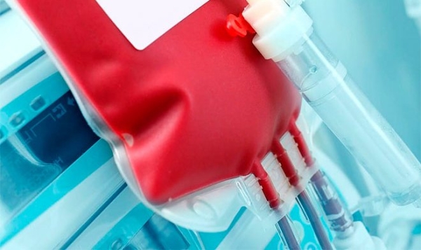 ТПУ объявил о создании первых в стране мембран для фильтрации крови