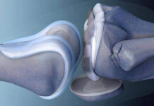 В Кабардино-Балкарии активно осваивают трехмерную биопечать имплантов