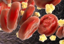 Комбинация двух препаратов снижает уровень холестерина в крови на 49 %