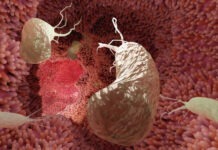 75% случаев рака желудка можно предотвратить с помощью простой профилактической меры