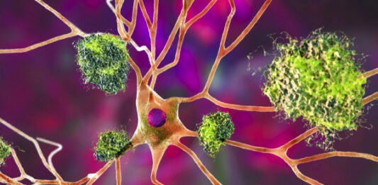 Белок-«виновник» Альцгеймера подзаряжает иммунные клетки и резко снижает риск рака