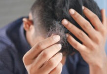 Натуральный подсластитель оказался необычайно полезным в борьбе с мужским облысением