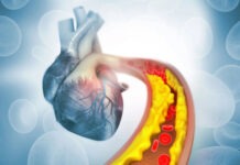 Одноразовая генная терапия навсегда снизит количество липидов в крови