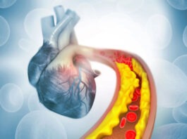 Одноразовая генная терапия навсегда снизит количество липидов в крови