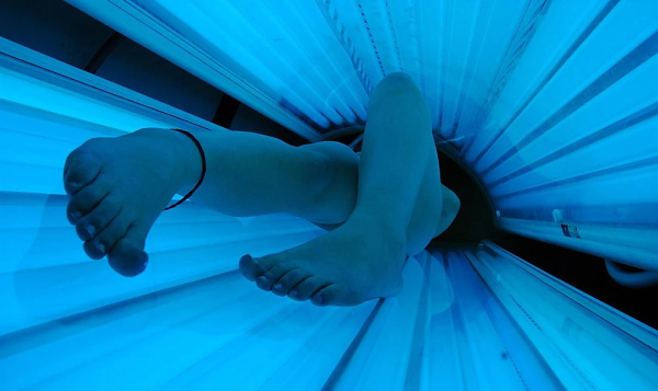 Солярии провоцируют мутации ДНК кожи и втрое увеличивают риск меланомы