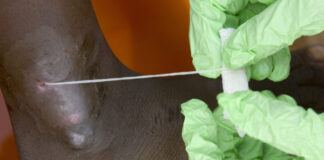 Человечество в шаге от полной победы над второй (после оспы) инфекционной болезнью в истории