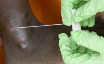 Человечество в шаге от полной победы над второй (после оспы) инфекционной болезнью в истории